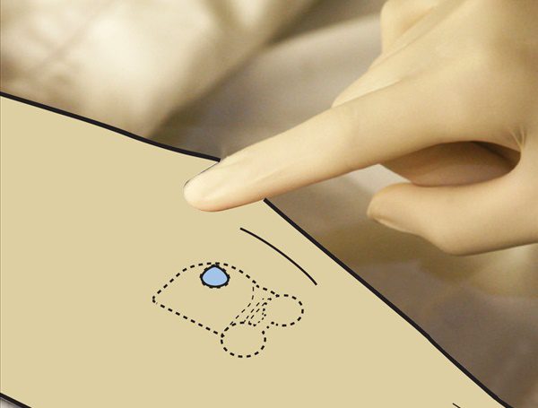 Implanted User Interfaces